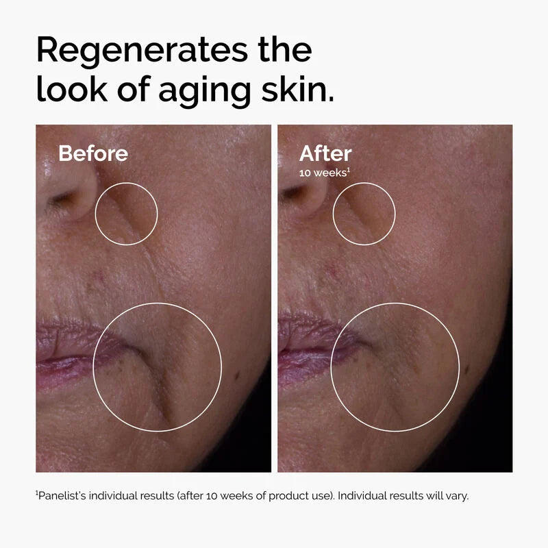 The Ordinary GF 15% Solution 30mL