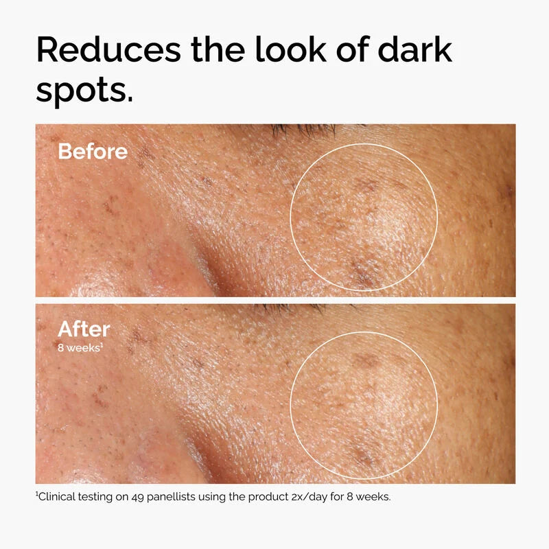 The Ordinary Alpha Arbutin 2% + HA
