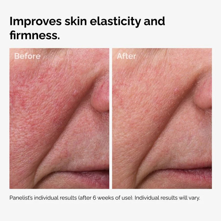 The Ordinary 100% Fermented Rose Hip Seed Oil